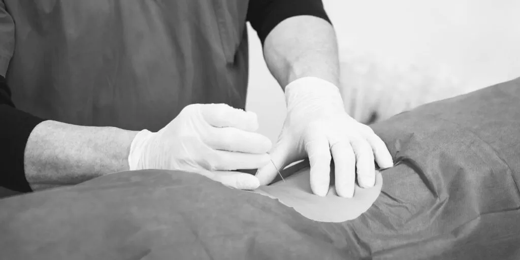 Terapia del dolor sin cirugía
